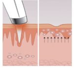 ماساژور چشم هومدیکس مدل EYE-100-EU - Image 6